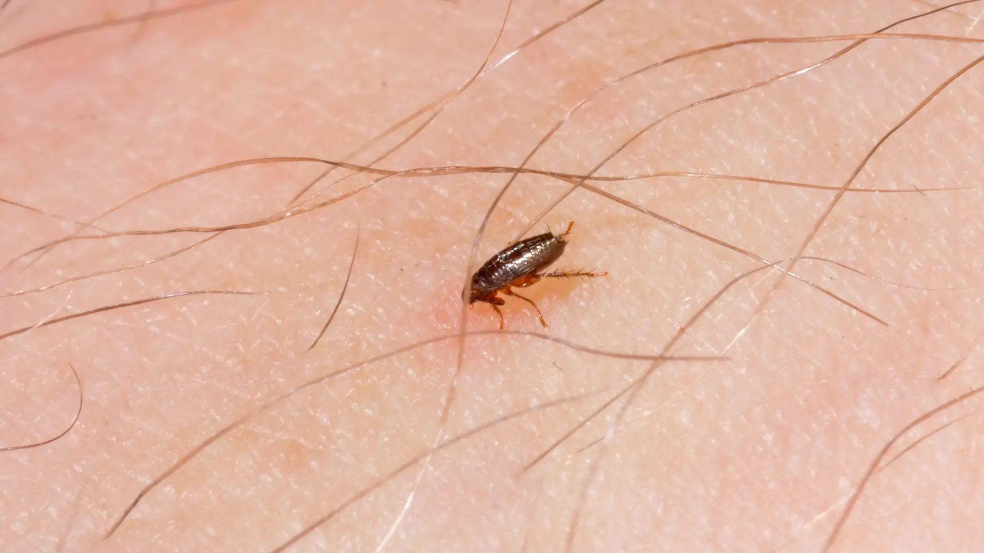 lea bites can be painful and uncomfortable. Learn about the causes of flea bites, their symptoms, and the best treatments and prevention methods. Stay informed and protect yourself from flea bites.